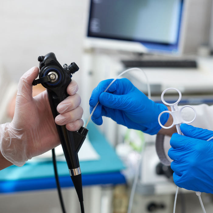 endoscopio endoallies