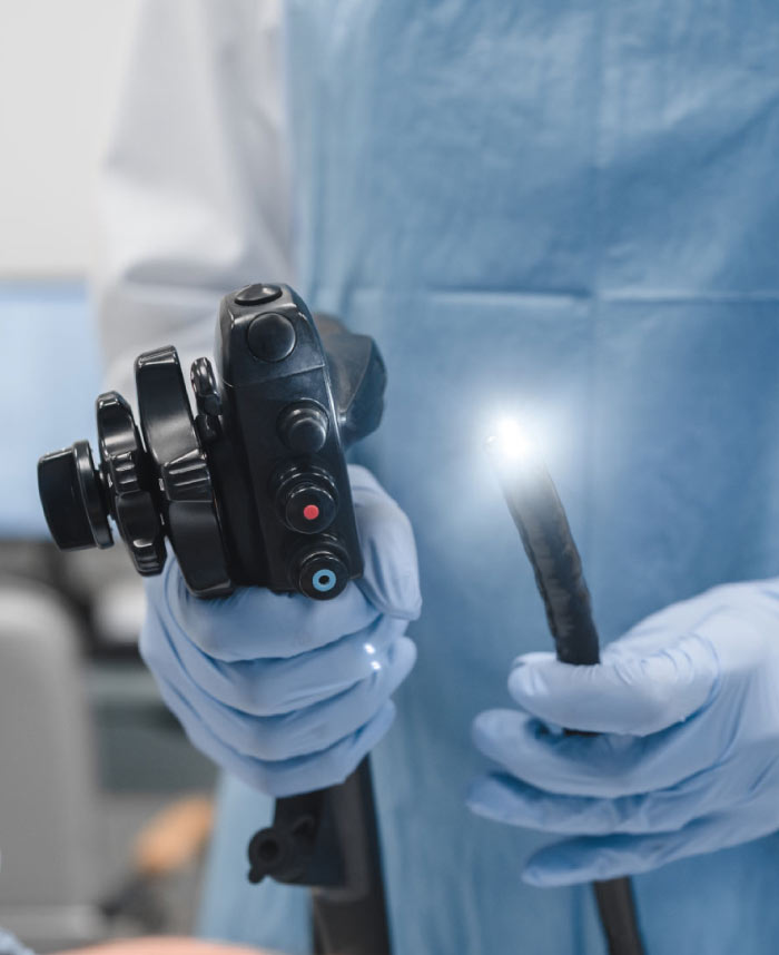 endoscopio endoallies